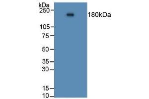 Rabbit Capture antibody from the kit in WB with Positive Control: Human lung tissue. (Angiotensin I Converting Enzyme 1 Kit CLIA)