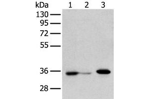 Western blot analysis of HepG2 cell Hela cell and A549 cell using DHRSX Polyclonal Antibody at dilution of 1:350 (DHRSX anticorps)