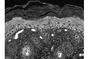TrpC7 Immunohistochemistry.