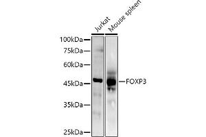 Western blot analysis of extracts of various cell lines, using (ABIN6133706, ABIN6140764, ABIN6140767 and ABIN6215622) at 1:500 dilution. (FOXP3 anticorps  (AA 50-150))