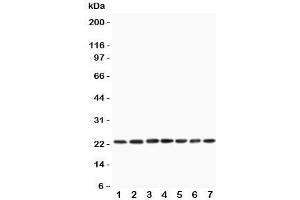 Western blot testing of CNTF antibody and rat samples 1:  PC12;  2: NRK;  3: RH35;  4: brain;  5: liver;  6: spleen;  7: testis lysate.