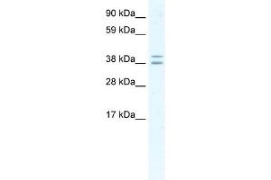 WB Suggested Anti-TSG101 Antibody Titration:  2. (TSG101 anticorps  (Middle Region))