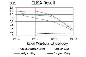 Black line: Control Antigen (100 ng), Purple line: Antigen(10 ng), Blue line: Antigen (50 ng), Red line: Antigen (100 ng),