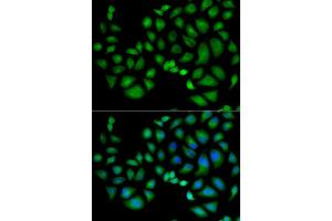 Immunofluorescence analysis of HeLa cells using CLIC1 antibody. (CLIC1 anticorps)