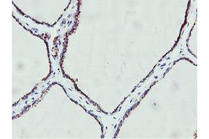 Image no. 3 for anti-Golgi Membrane Protein 1 (GOLM1) antibody (ABIN1498496)