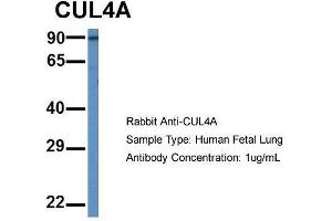Host: Rabbit  Target Name: CUL4A  Sample Tissue: Human Fetal Lung  Antibody Dilution: 1.