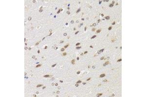 Immunohistochemistry of paraffin-embedded rat brain using BAZ1B antibody.