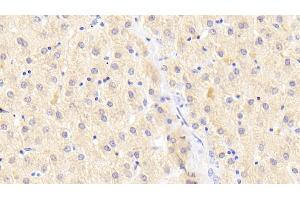Detection of ATG16L1 in Human Liver Tissue using Polyclonal Antibody to Autophagy Related Protein 16 Like Protein 1 (ATG16L1) (ATG16L1 anticorps  (AA 1-284))