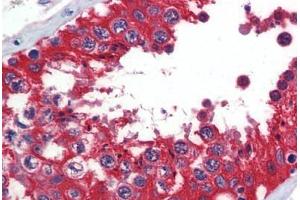 Human Testis (formalin-fixed, paraffin-embedded) stained with  antibody ABIN462273 followed by biotinylated secondary antibody, alkaline phosphatase-streptavidin and chromogen. (Glucose-6-Phosphate Dehydrogenase anticorps  (AA 35-506))