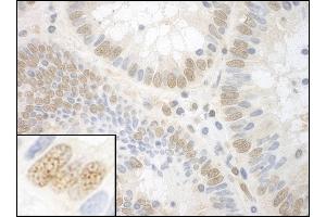 anti-Nuclear Protein, Ataxia-Telangiectasia Locus (NPAT) (AA 1377-1427) antibody