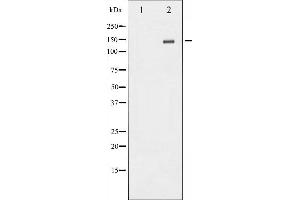 Western blot analysis of NMDAR2B phosphorylation expression in TNF treated Jurkat whole cell lysates,The lane on the left is treated with the antigen-specific peptide. (GRIN2B anticorps  (pTyr1336))