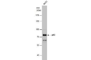 WB Image p63 antibody detects p63 protein by western blot analysis. (p63 anticorps)