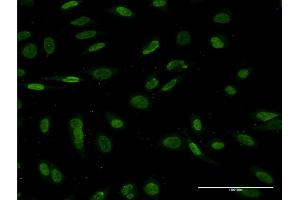 Immunofluorescence of monoclonal antibody to NKX2-1 on HeLa cell.