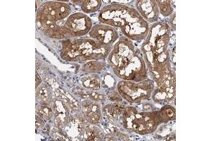 Immunohistochemical staining of human kidney with TPCN1 polyclonal antibody  shows moderate cytoplasmic positivity in cells in renal tubules at 1:20-1:50 dilution. (TPCN1 anticorps)
