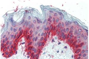 Human Skin (formalin-fixed, paraffin-embedded) stained with TFAP2C antibody ABIN462192 followed by biotinylated goat anti-rabbit IgG secondary antibody ABIN481713, alkaline phosphatase-streptavidin and chromogen.