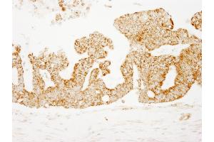 Immunohistochemistry (IHC) image for anti-Cytochrome C Oxidase Subunit IV Isoform 1 (COX4I1) (AA 25-75) antibody (ABIN7448484)