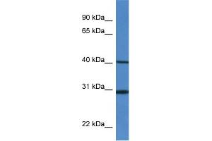 WB Suggested Anti-H13 Antibody   Titration: 1. (H13 anticorps  (Middle Region))