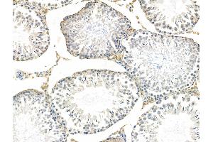 ABIN6258292 and ABIN6276010 at 1/100 staining Rat testis tissue by IHC-P. (GPR135 anticorps  (Internal Region))