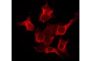 ABIN6276207 staining Hela by IF/ICC. (PRLHR anticorps  (Internal Region))