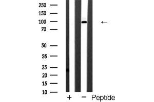 anti-Glutamate Receptor, Metabotropic 4 (GRM4) (C-Term) antibody