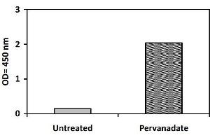 Image no. 3 for Bruton Agammaglobulinemia tyrosine Kinase (BTK) ELISA Kit (ABIN1981713)