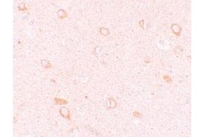 Immunohistochemical staining of human brain cells with CIITA polyclonal antibody  at 10 ug/mL.