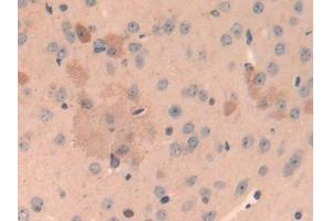 IHC-P analysis of Mouse Cerebrum Tissue, with DAB staining. (Cathepsin L anticorps  (AA 18-113))