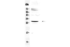 Western blot analysis of SIX6 using anti-SIX6 antibody . (SIX Homeobox 6 anticorps  (AA 188-246))