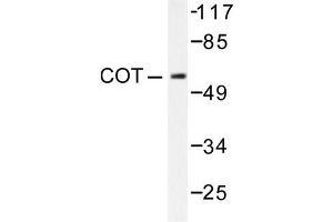 Image no. 1 for anti-Mitogen-Activated Protein Kinase Kinase Kinase 8 (MAP3K8) antibody (ABIN265369) (MAP3K8 anticorps)