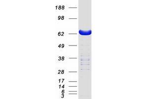 Validation with Western Blot