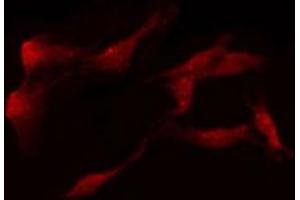 ABIN6274306 staining LOVO by IF/ICC.