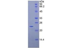 SDS-PAGE analysis of Rat CD8b Protein.