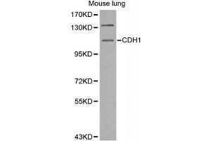 Western Blotting (WB) image for anti-Cadherin 1, Type 1, E-Cadherin (Epithelial) (CDH1) antibody (ABIN6220010) (E-cadherin anticorps)