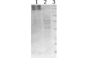 Western-Blot detection of human RET expressed in CHO cells.