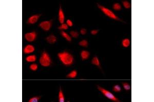 Immunofluorescence analysis of U2OS cells using KIF2C Polyclonal Antibody (KIF2C anticorps)