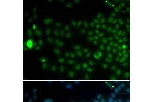 Immunofluorescence analysis of MCF-7 cells using SPDYA Polyclonal Antibody (SPDYA anticorps)