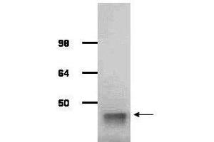 IgG purified antibody to rabbit muscle aldolase (, 200-1141 and 200-1341) was used at a 1:1000 dilution to detect human aldolase by Western blot.