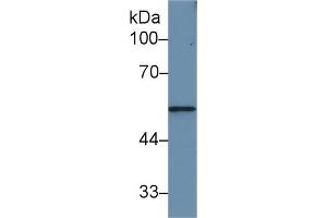 Detection of MMP12 in Rat Small intestine lysate using Polyclonal Antibody to Matrix Metalloproteinase 12 (MMP12)
