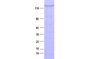 Validation with Western Blot