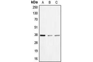 Western blot analysis of BNIP2 expression in HEK293T (A), mouse liver (B), rat liver (C) whole cell lysates.