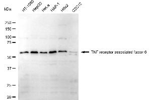 Western blotting analysis using TNF receptor associated factor 6 antibody (ABIN7800566).