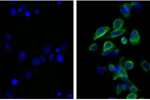 Human pancreatic carcinoma cell line MIA PaCa-2 was stained with Mouse Anti-Cytokeratin 18-UNLB and DAPI. (Rat anti-Souris IgG2b Anticorps (FITC))