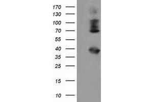 Western Blotting (WB) image for anti-Heat Shock Protein 70 (HSP70) antibody (ABIN1498749) (HSP70 anticorps)