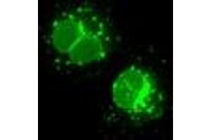 Anti-LEMD3 mouse monoclonal antibody (ABIN2453230) immunofluorescent staining of COS7 cells transiently transfected by pCMV6-ENTRY LEMD3 (RC212759). (LEMD3 anticorps)