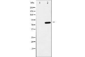 Western blot analysis of p62 Dok phosphorylation expression in K562 whole cell lysates,The lane on the left is treated with the antigen-specific peptide. (DOK1 anticorps  (pTyr398))