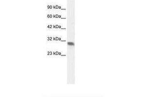 Image no. 2 for anti-Four and A Half LIM Domains 2 (FHL2) (AA 199-248) antibody (ABIN202003) (FHL2 anticorps  (AA 199-248))