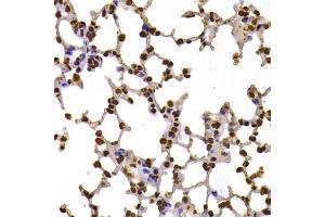 Immunohistochemistry of paraffin-embedded mouse lung using FBXW7 antibody (ABIN5975397) at dilution of 1/100 (40x lens). (FBXW7 anticorps)