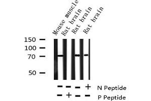 Western blot analysis of Phospho-p70 S6 Kinase (Ser424) expression in various lysates