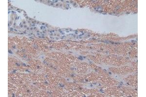 IHC-P analysis of Rat Cerebrum Tissue, with DAB staining. (CXCL1 anticorps  (AA 25-96))