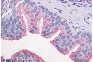 Immunohistochemical (Formalin/PFA-fixed paraffin-embedded sections) staining in human prostate, epithelium with GPR87 polyclonal antibody . (GPR87 anticorps  (C-Term))